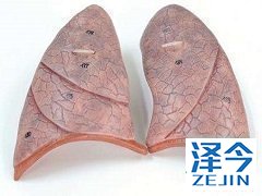 尼达尼布胶囊治疗肺纤维化的作用机制