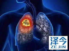 尼达尼布说明书中的适应症和注意事项有哪些