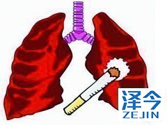 尼达尼布可使特发性肺纤维化患者长期获益