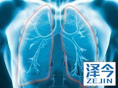 尼达尼布获批与国内特发性肺纤维化市场PK进行时