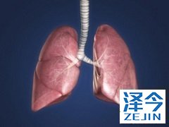 特效药尼达尼布你真的了解它吗？