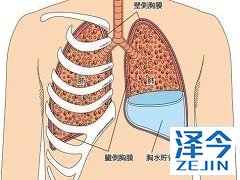 尼达尼布联合多西他赛治疗非小细胞肺癌的效果如何？