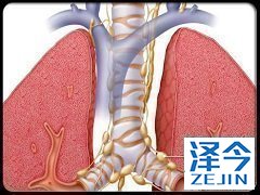 尼拉帕尼授予突破性治疗指定为患者带来更多的治疗选择