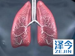 ASCO2017尼达尼布治疗恶性胸膜间皮瘤效果如何