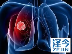 尼达尼布的副作用处于可控范围内