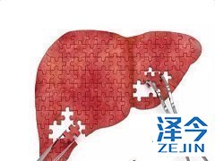 尼达尼布可致患者肝损伤